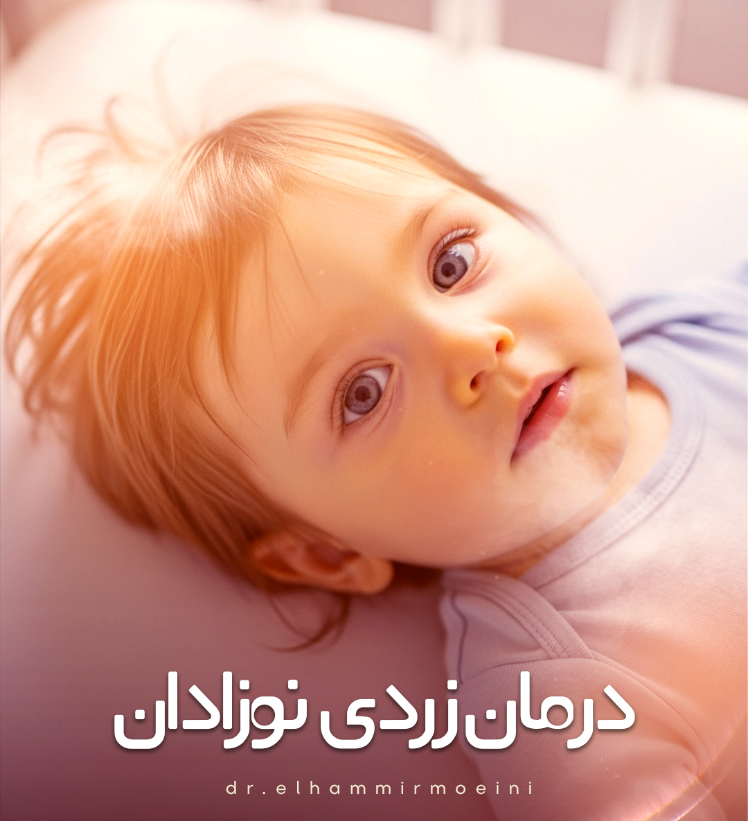 درمان زردی نوزادان